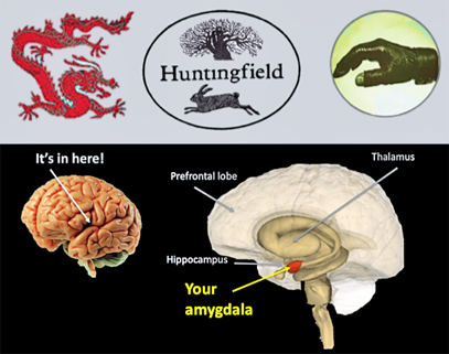 Amygdala